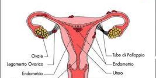 Salute/Donna: l’endometriosi come affrontarla